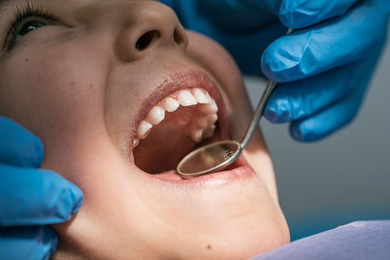 a dental mirror in an open mouth